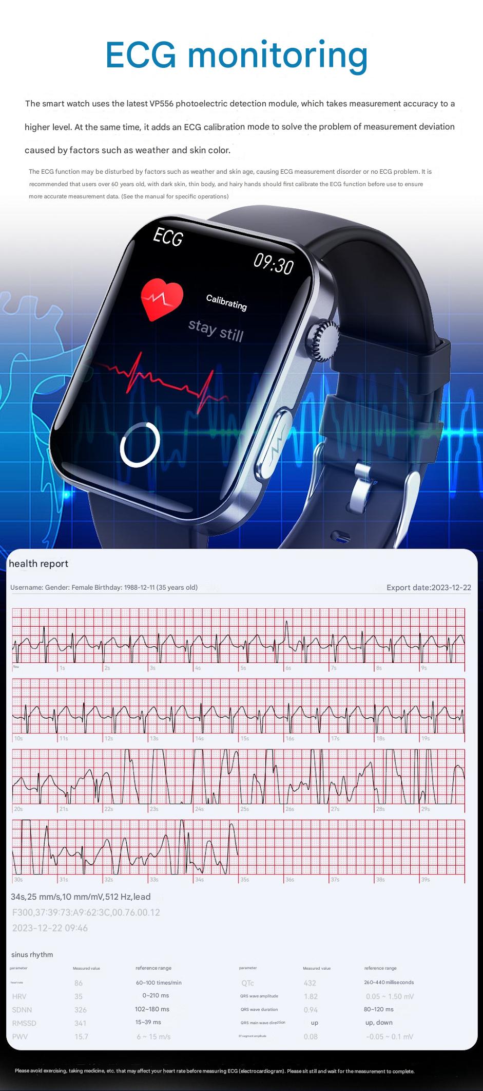 F300 Smartwatch with ECG
